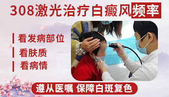 河北省哪个医院皮肤科有308激光