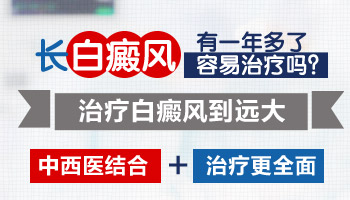白癜风一年多了一直不变大也不变小