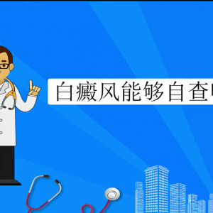 白癜风能够自查吗