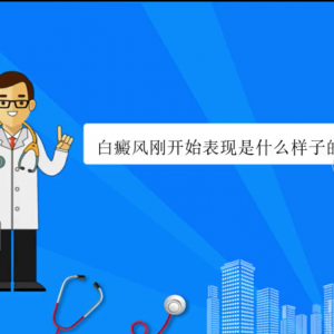白癜风刚开始表现是什么样子的