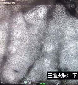 石家庄白癜风医院公益援助案例