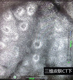 石家庄白癜风医院公益援助案例