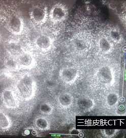 石家庄白癜风医院公益援助案例