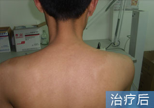 石家庄白癜风医院健康达人