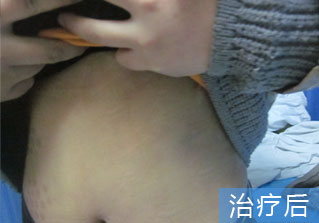 石家庄白癜风医院健康达人