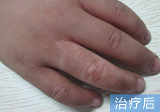 石家庄白癜风医院健康达人