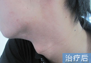 石家庄白癜风医院健康达人