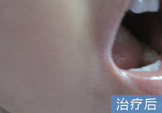 石家庄白癜风医院健康达人