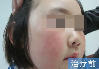 石家庄白癜风医院健康达人