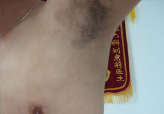 石家庄白癜风医院健康达人